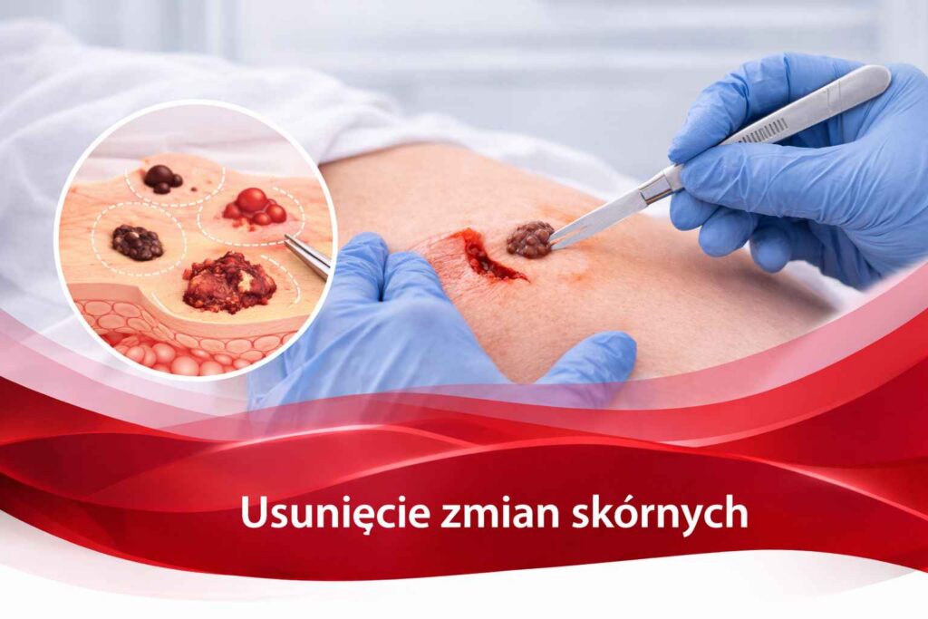 zmiany
