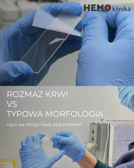 rozmaz krwi